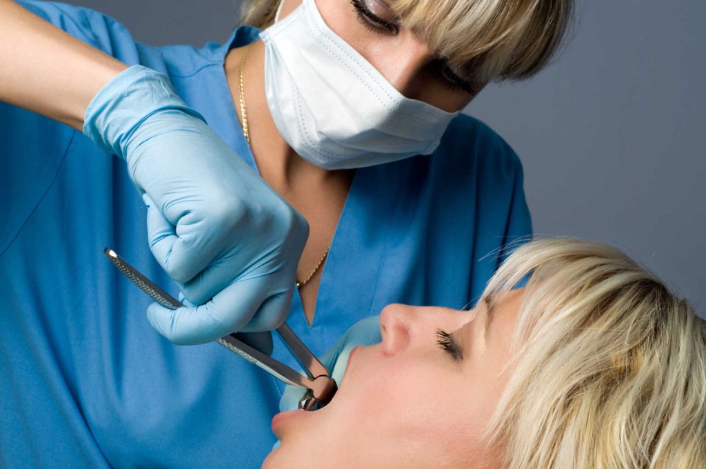 Chirurgie orale et dentaire, extraction de dent de sagesse par un chirugien dentiste